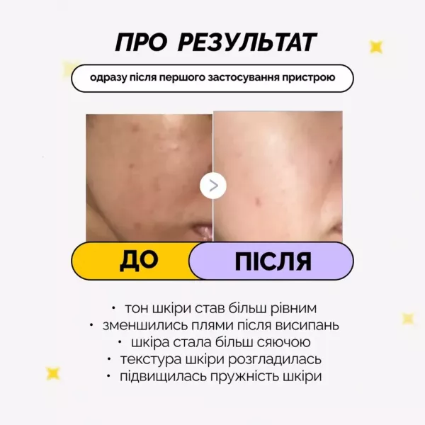 Пристрій для догляду за обличчям Medicube AGE-R Booster Pro Mini (Pink)